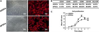 Bovine-Derived Xenografts Immobilized With Cryopreserved Stem Cells From Human Adipose and Dental Pulp Tissues Promote Bone Regeneration: A Radiographic and Histological Study